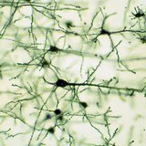 Νευρικός ιστός