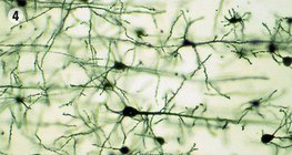 Νευρικός ιστός