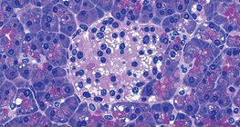 Group of cells in the pancreas that produce insulin