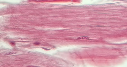 Τένοντας (διαμήκης τομή)