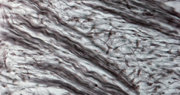 Fibrocartilage tissue (nose of pig embryo)