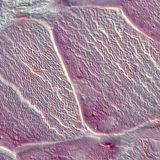 Τένοντας (διατομή)