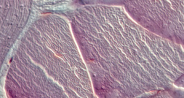 Τένοντας (διατομή)