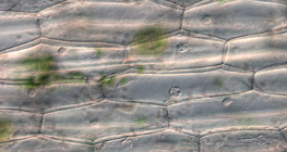 Επιδερμικά κύτταρα φυτών