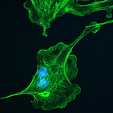 Κυτταροσσκελετός (κύτταρα του πνεύμονα βοοειδών)