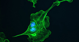 Κυτταροσσκελετός (κύτταρα του πνεύμονα βοοειδών)