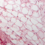 Fatty tissue