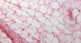 Fatty tissue