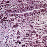 Διατομή ποδιού σαλιγκαριού