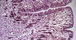 Διατομή ποδιού σαλιγκαριού