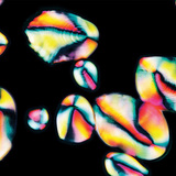 Κοκκίδια αμύλου σε πατάτα