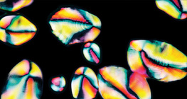 Κοκκίδια αμύλου σε πατάτα