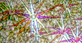 Stellate hairs