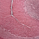 Τομή ανθρώπινης παρεγκεφαλίδας