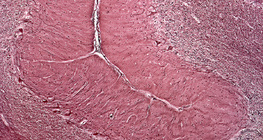 Τομή ανθρώπινης παρεγκεφαλίδας