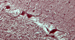 Purkinje neurons (section of human cerebellum)