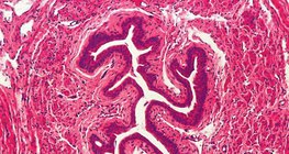 Microscopic view of human ureter