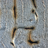 Οστό (διαμήκης τομή)