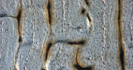 Οστό (διαμήκης τομή)