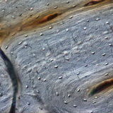 Οστό (διαμήκης τομή)