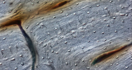 Οστό (διαμήκης τομή)