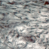 χαλαρός συνδετικός ιστός