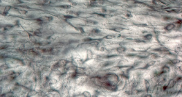 χαλαρός συνδετικός ιστός