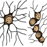 νευρογλοιακά κύτταρα