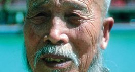 Μογγολοειδής