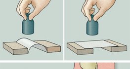 Examination of the arch of the foot