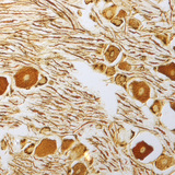 Νευρικά κύτταρα στο νωτιαίο γάγγλιο