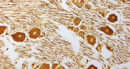 Νευρικά κύτταρα στο νωτιαίο γάγγλιο