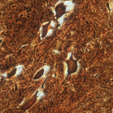 Νευρικά κύτταρα στο νωτιαίο μυελό (βοοειδή)