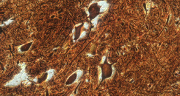 Νευρικά κύτταρα στο νωτιαίο μυελό (βοοειδή)