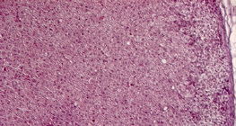 Τομή επινεφριδίου