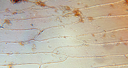 Κύτταρα από τα σαρκώδη φύλλα ενός κρεμμυδιού