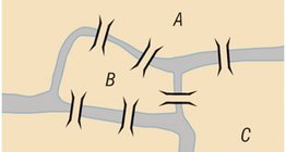 Οι Επτά γέφυρες του Κένιγκσμπεργκ