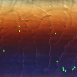 Φθορίζοντα βακτήρια E.coli στα μαλλιά