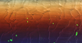 Φθορίζοντα βακτήρια E.coli στα μαλλιά