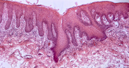 Cross section of human tongue