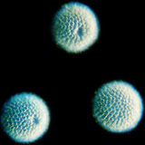 Sponge spicules - spherical (Geodia cydonium)