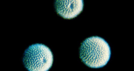 Sponge spicules - spherical (Geodia cydonium)
