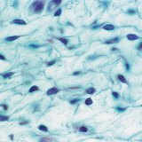 χαλαρός συνδετικός ιστός