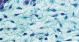 χαλαρός συνδετικός ιστός