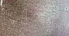 Ανθρώπινος εγκεφαλικός φλοιός με τα διαφορετικά κυτταρικά στρώματα