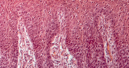 Cross section of human tongue