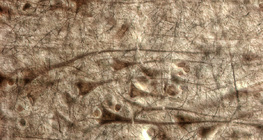 Ανθρώπινος εγκεφαλικός φλοιός με γιγαντιαία πυραμιδοειδή κύτταρα