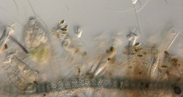 Water from a fish tank with vorticella, stentor and algae