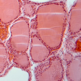 Τομή θυρεοειδούς αδένα