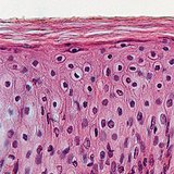 Keratinised stratified squamous